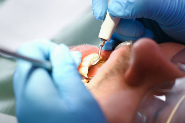 Best Emergency Dental Services for Seniors in Woodstock, IL